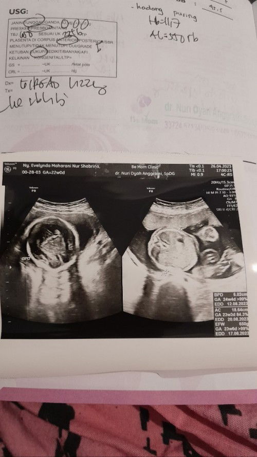 Gestational Age yang bener yg mana