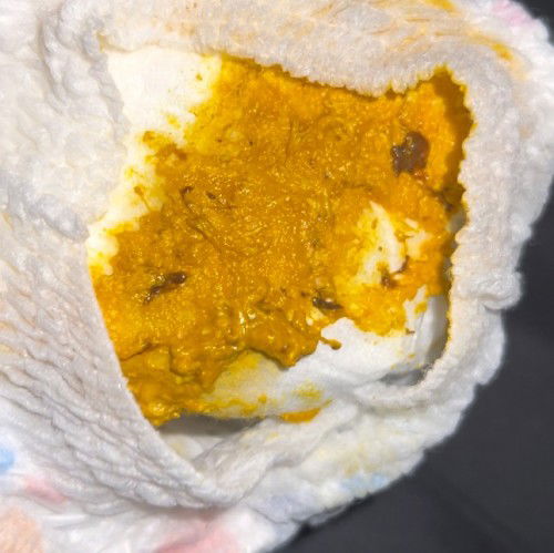 อึลูกแลบบนี้ปกติไหมค่ะ