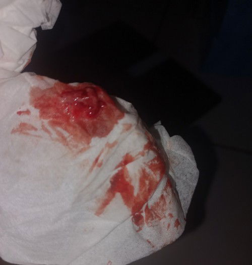 Keluar darah setelah berhubungan pada usia kehamilan 37 weeks