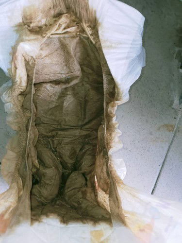 Anak saya berak gelap coklat