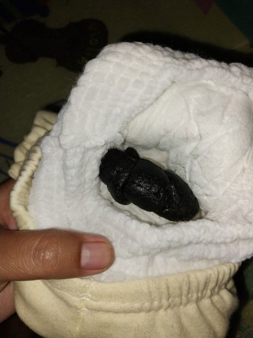 Bab bayi 7bulan kurang 1 minggu