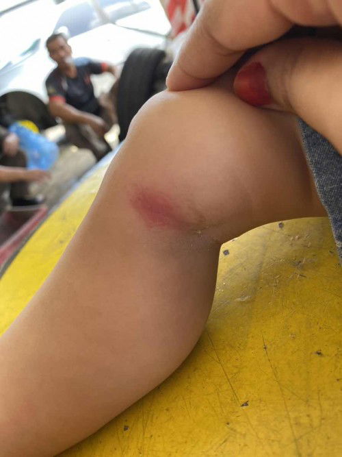 ada tak cara nak hilangkan