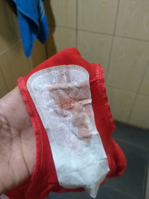 Ada yang lgi ngerasaain g Bun, keluar lendir dan darah tp belum ada pembukaan?
