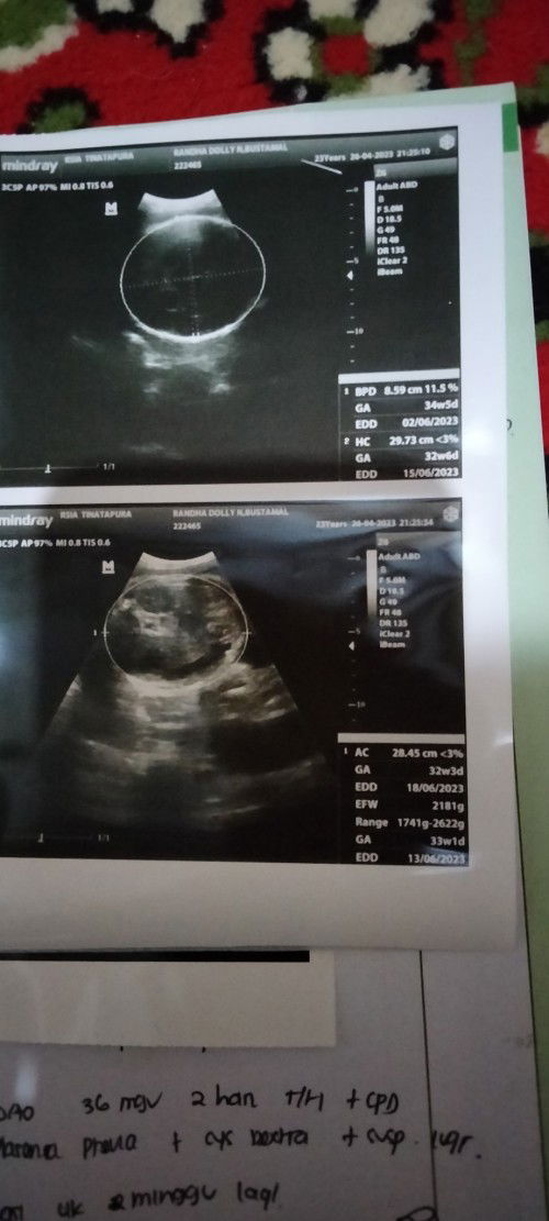 Berapa bulan yah bund?