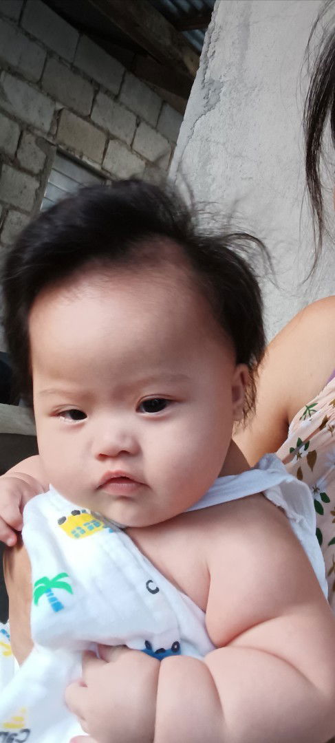 Mga mami okay lang ba shape ng ulo ni baby 5 months old