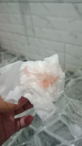 Keluar Lendir campur darah
