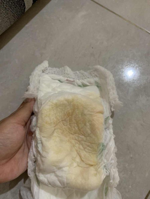 Warna pipis bayi