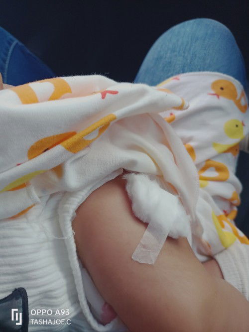 Cucuk hexaxim- 2 bulan