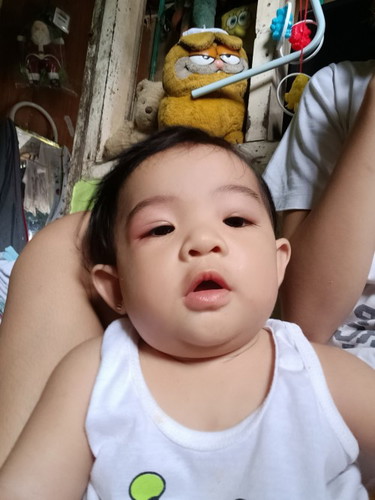 Kagat ng langgam