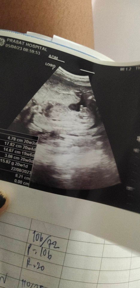 อยากทราบเพศค่ะ