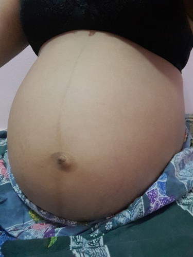 สอบถามแม่ๆหน่อยค่ะ 36+1