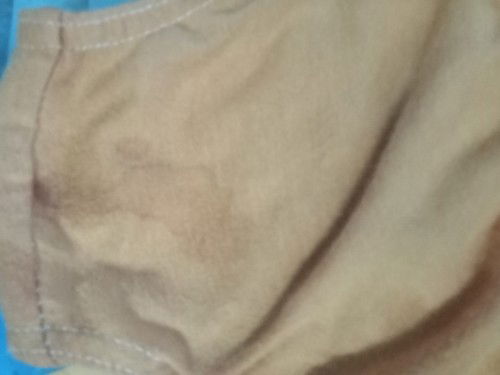 bleeding On April 27 2023