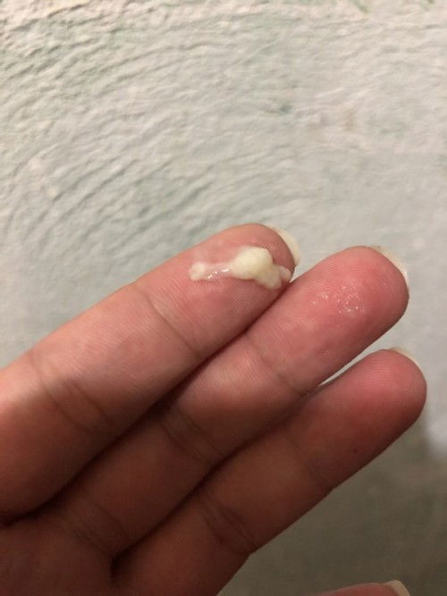 Mucus Plug at 36 weeks and 4 days