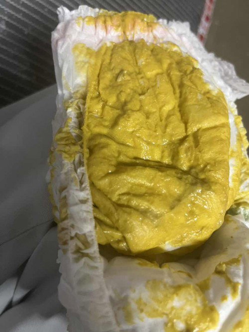 ลูก6เดือนกินนมผง ขี้แบบนี้ปกติไหมค่ะ