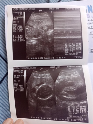 Paano po yung ginawa nyo para mapaharap si baby sa ultrasound? 21+5 na sya di pa rin kita gender