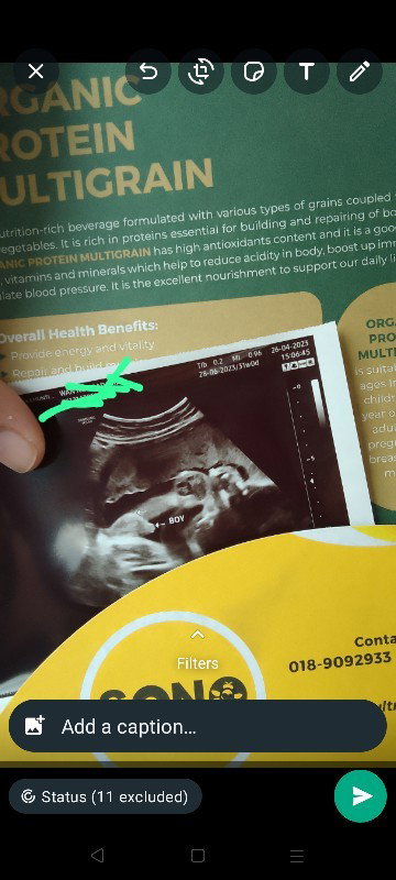 Hai mommy klau mcm ni confirm boy tak..doktor ckp boy ,ada kmngkinan kluar girl tak..teringin boboy.