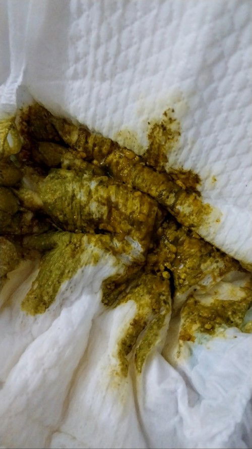 Warna BAB bayi 2 bulan