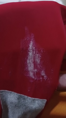 White discharge?