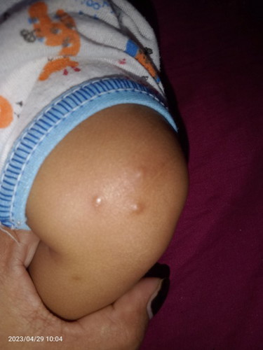 Bun anak sya kog di tangan sma kaki ada Bintik dan ada airnya kenapa ya bun yaa....??