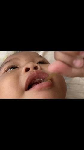 ฟันบนลูกมีแง่งๆ แบบนี้คืออะไรหรอคะ ต้องไปปรึกษาหมอเลยมั้ยรึปกติ