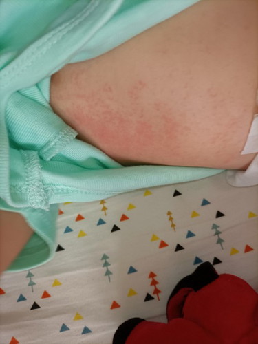 Red patch rashes