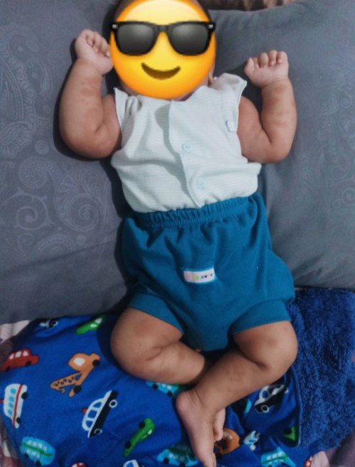 Badan bayi 1 bulan merah"