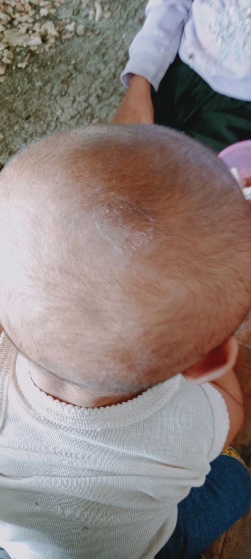 Kepala anak kayak kotor