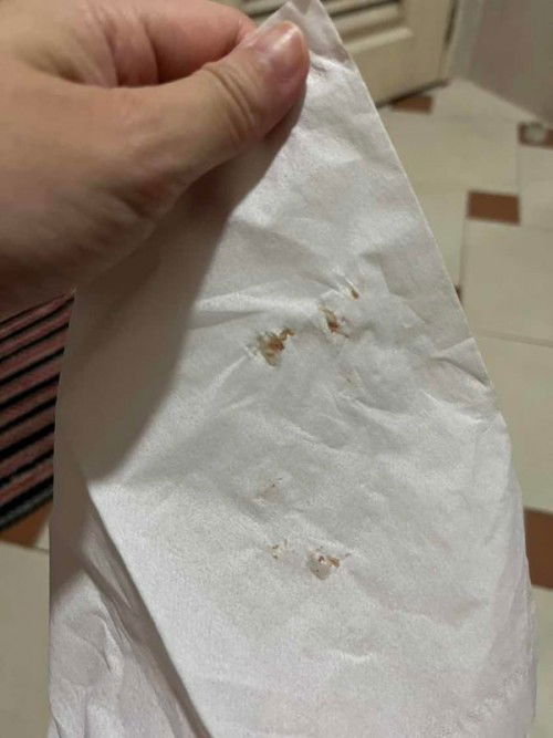 มีน้ำไหลออกจากหัวนม