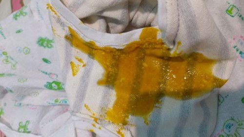 น้องถ่ายเป็นเมือกแบบนี้ปกติไหมคะ