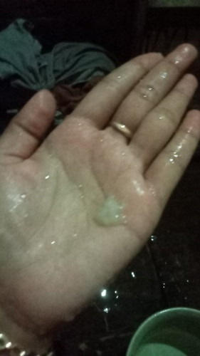 maaf jorok ya bun, tadi pas BAK keluar keputihan kyk gini worry bgt bun