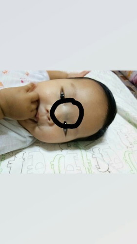 Ugat ni baby sa may ilong