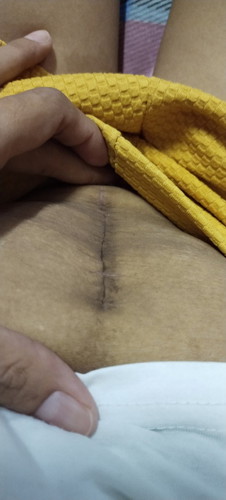 Ask lng po...pagaling na po ba'to?1 month na po kmi n baby sa katapusan.thanknu po sa sssgot