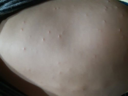 Ini alergi atau kenapa ya moms? Sy khawatir.. makasih..