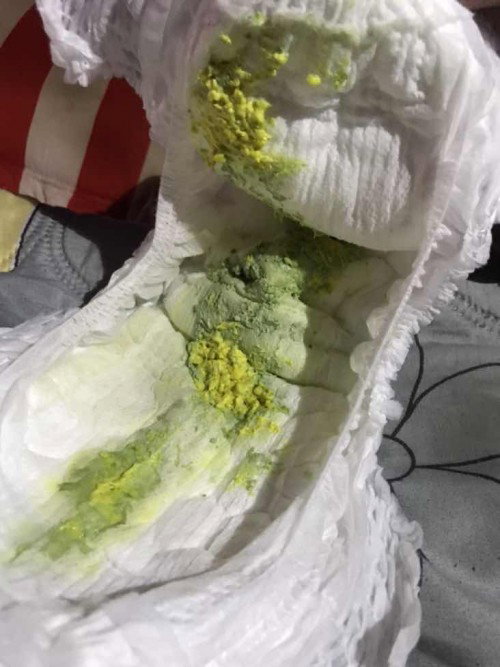น้องอึสีเขียวปนปกติไหมคะ