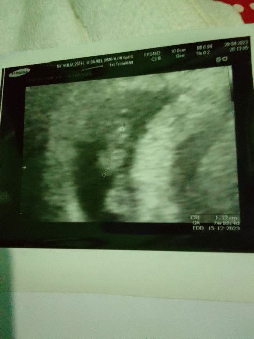 Hpht dan hasil usg beda