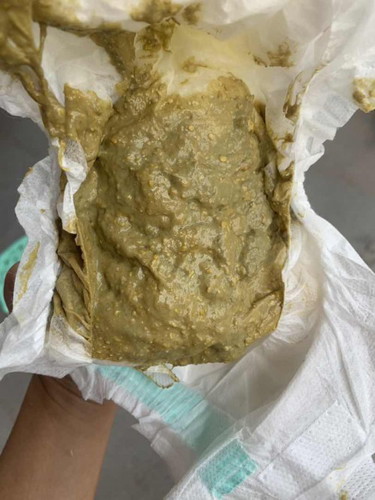 อึแบบนี้ปกติมั้ยค่ะ แพ้นมวัว หรือแพ้อะไรรึป่าว