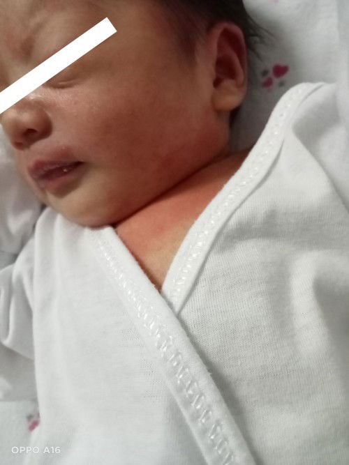 Normal po ba ito mga mii??