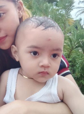 Bekas luka jahitan anak