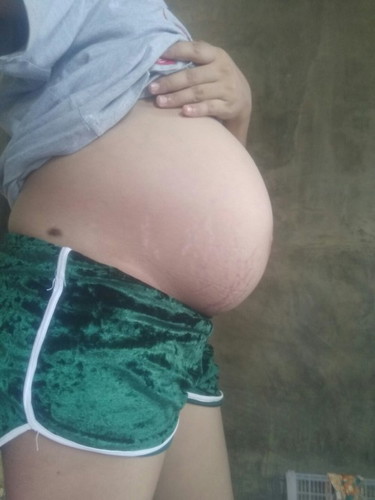 36 weeks & 3 days