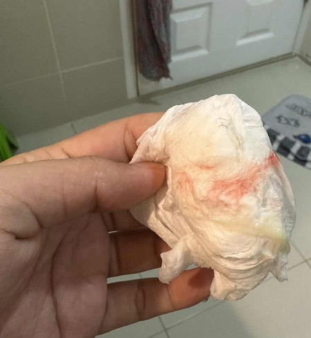 38+6 วีค ตื่นเช้ามามีมูก+เลือด ท้องแข็งถี่มาก