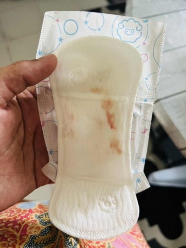 flek darah 36week