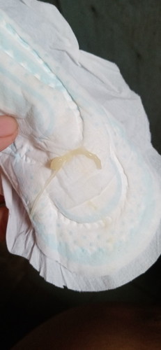 Mucus plug?