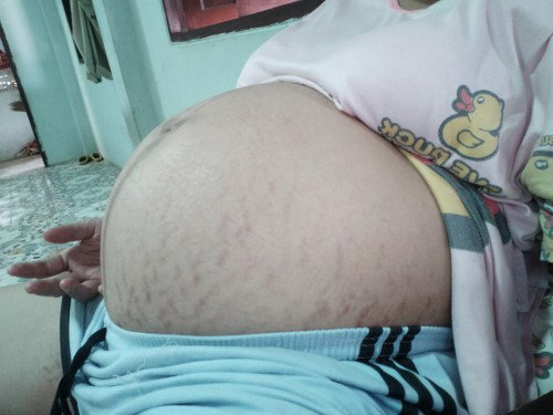 ท้องแรกค่ะแม่เป็นคนตัวเล็กมาก่อน