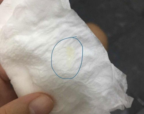 วันนี้38วีคพอดี เเบบนี้คือตกขาวหรือมูกคะ