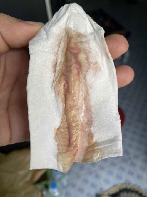 ช่วงมีมูกเลือดออก แบบนี้ตลอดเลยตอนเช้าๆ มีปวดท้องแข็งบ้างแต่ไม่ถี่ แม่ๆบ้านไหนเป็นแบบเราบ้าง ตอนนี้36+6แล้วไปหาหมอก็ให้กับบ้าน