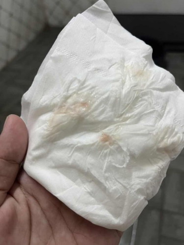 38+5 มีเลือดปนมูก