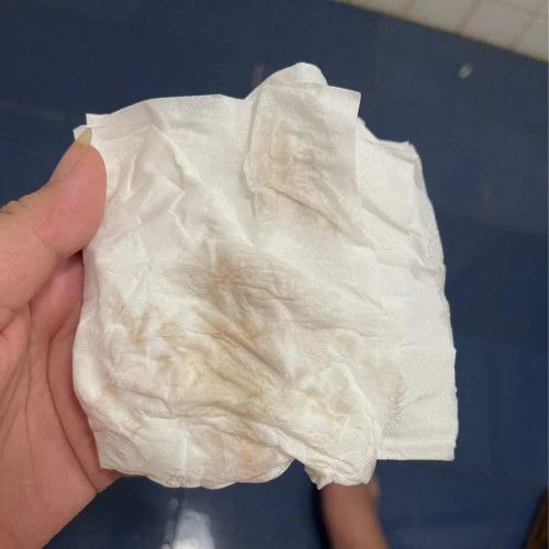 แท้งคุกคามใช่แบบนี้หรือเปล่าค่ะ