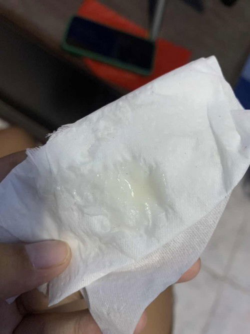 สอบถามน่อยคะแบบนี้ตกขาวปกติมั้ย