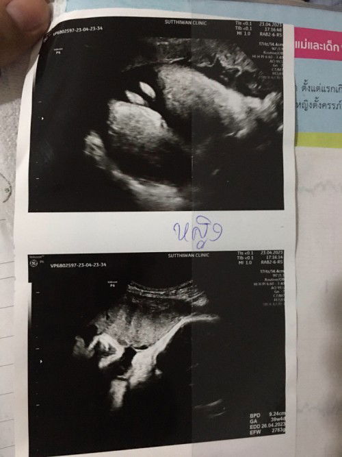 คุณหมอบอกผู้หญิง แต่คุณยายบอกผู้ชาย🤣