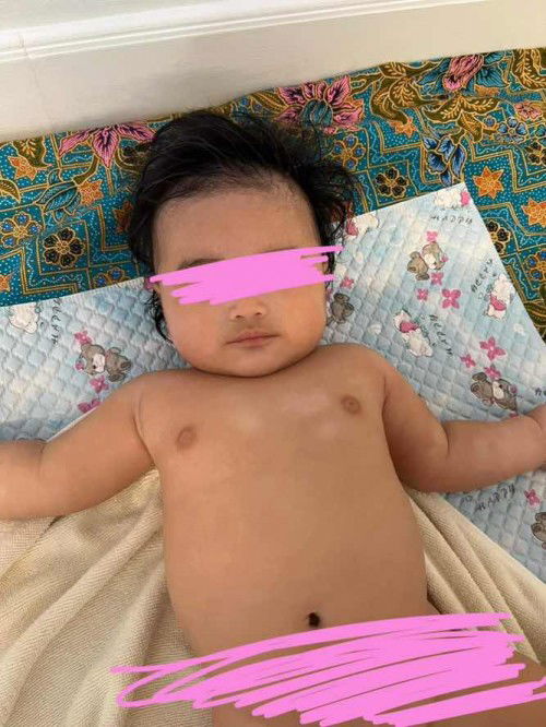 วงกลมขาวๆตรงหน้าอกเกิดจากอะไร